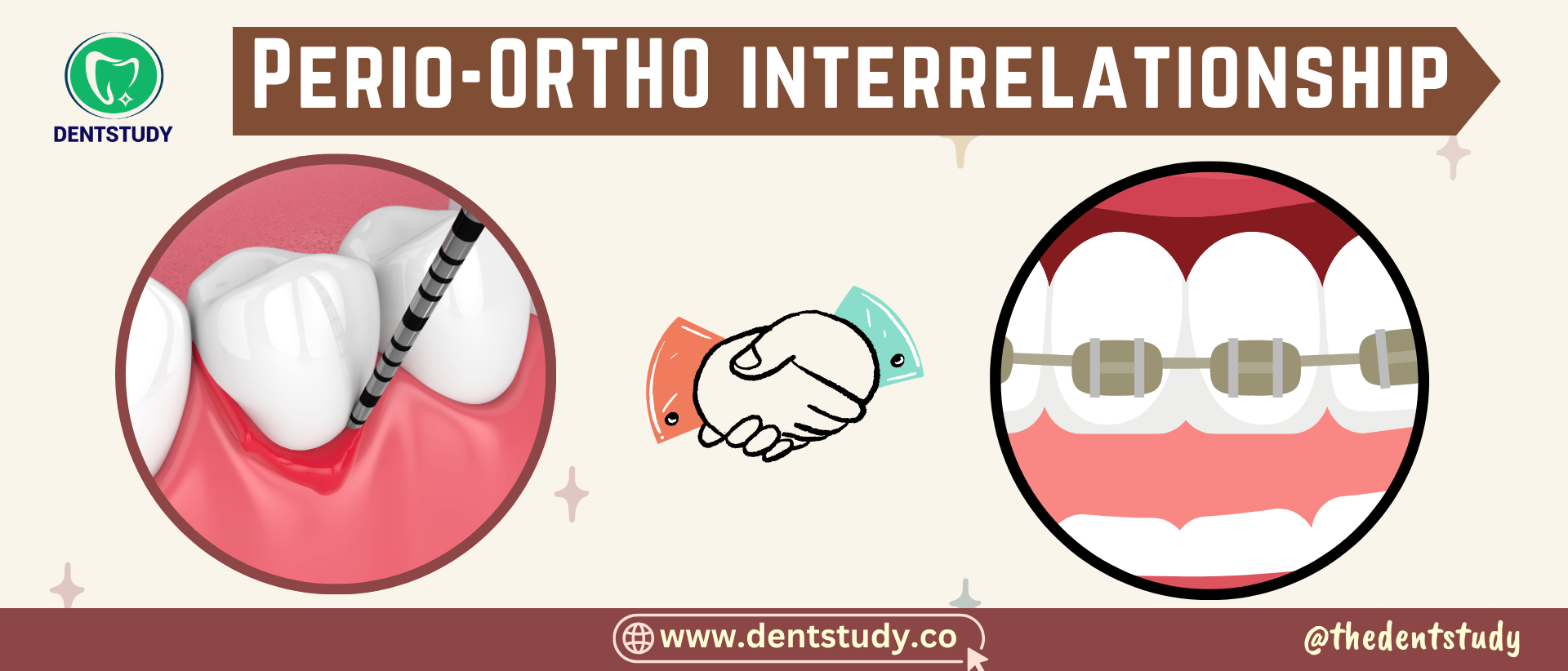 INTERDISCIPLINARY APPROACH PERIODONTICS-ORTHODONTICS RELATIONSHIP