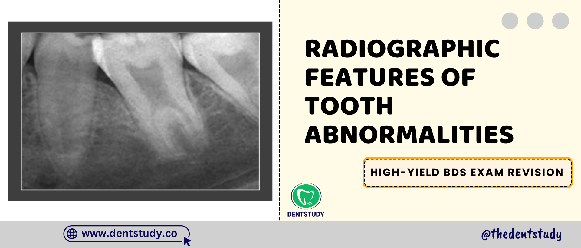 Radiographic Features of Tooth Abnormalities-High-Yield Exam Guide