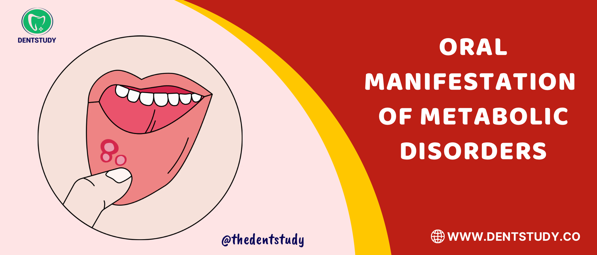 Oral Manifestations of Metabolic Disorders: High-Yield Exam Revision
