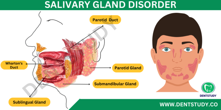 CLASSIFICATION OF SALIVARY GLAND DISORDERS