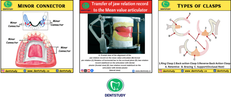 PROSTHODONTICS  DEFINITIONS FOR DENTAL STUDENTS