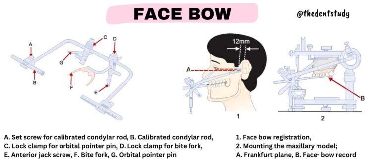 PROSTHODONTICS DEFINITIONS FOR DENTAL STUDENTS