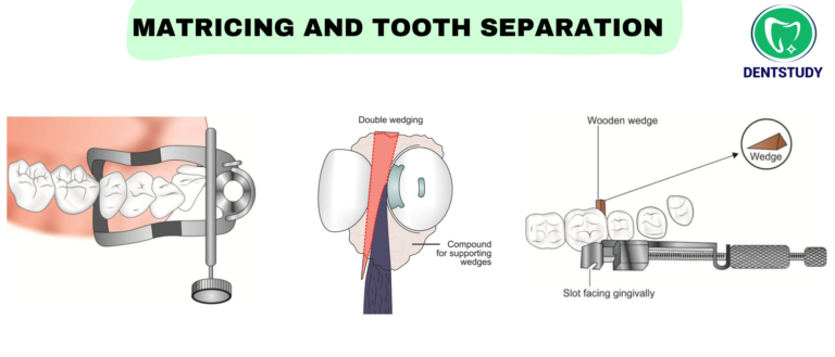 “Cracking the Viva: Important Questions & Answers for Conservative Dentistry “