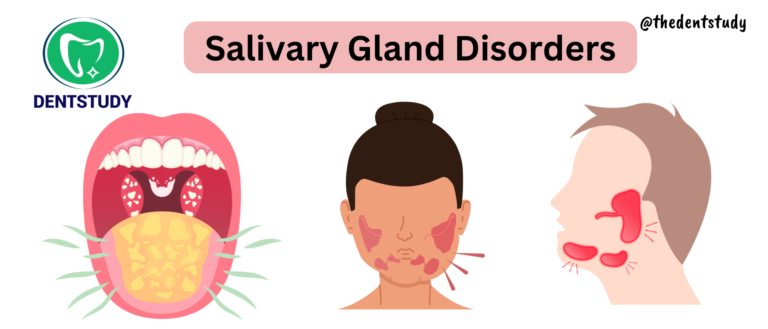 SALIVARY GLANDS DISORDERS