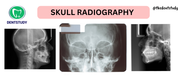 SKULL RADIOGRAPHY