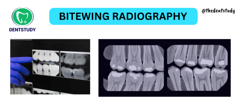 BITEWING RADIOGRAPHY