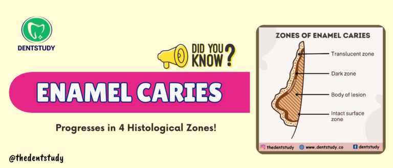 Histological Zones of Enamel Caries- (Easy Diagram Guide for Dental Students)