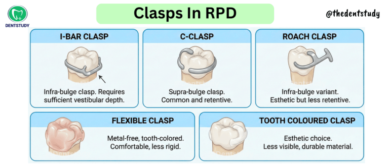 Clasps in RPD: Types, Functions: Easy Guide for Dental Students