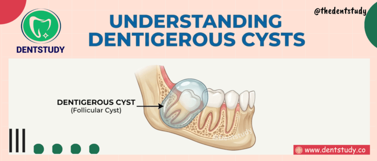 Dentigerous Cyst Explained: Features, Radiology & High-Yield Exam Facts